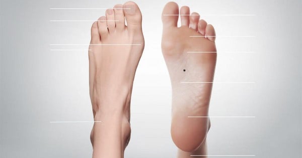 Quelle signification spirituelle pour un grain de beauté sur les jambes ou les pieds